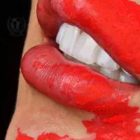 لمینیت/ترمیم دندان/کامپوزیت/پالیش/روکش ایمپلنت|خدمات آرایشگری و زیبایی|تهران, تهران پارس|دیوار