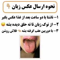 مشاوره رایگان زبان توسط استاد طب سنتی