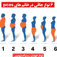 پکیج لاغری با ایمبیدینگ و طب سوزنی رایگان
