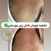 فیشال ۳۵۰ به مدت محدود،تمام خدمات به صورت حرفه ای|خدمات آرایشگری و زیبایی|صدرا-فارس, فاز ۱|دیوار