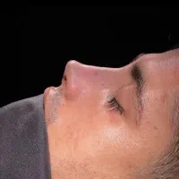 راهنمایی بینی