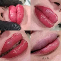 میکرو فیبروز بلد بروز تخفیف یلدایی|خدمات آرایشگری و زیبایی|گرگان, |دیوار