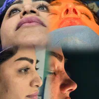 عمل بینی با قیمت اقتصادی پزشک متخصص در تهران