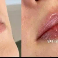 خدمات زیبایی توسط کادر درمان