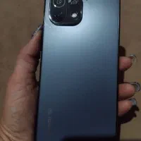 شیائومی می۱۱