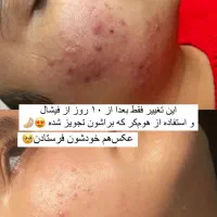 فیشال درمانی جوانسازی 9سال سابقه کار(ویژه بانوان)