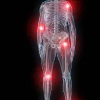 درمان تمامی دردهای مفصلی|خدمات آرایشگری و زیبایی|فومن, |دیوار