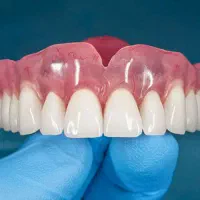 دندان مصنوعی