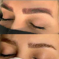 لیزر موهای زائد/ریمو تتو/لاغری/ژل/بوتاکس|خدمات آرایشگری و زیبایی|تهران, سعادت‌آباد|دیوار