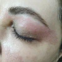 پلاسما پلکسر وقیمت باورنکردنی ۲۰۰هزار