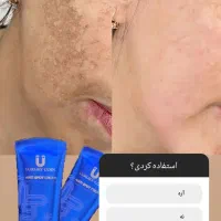 ضدلک اصل فرانسوی|حراج|قم, زنبیل آباد|دیوار