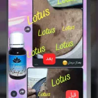 کرم مروارید بیواکوا|آرایشی، بهداشتی، درمانی|صدرا-فارس, فاز ۱|دیوار