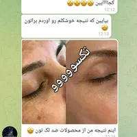 کاهش اشتها،لاغری،پاکسازی کبد،کیست وتنبلی تخمدان|خوردنی و آشامیدنی|تربت‌حیدریه, حیدرآباد|دیوار