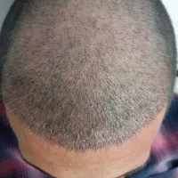 کاشتمو،ابرو،ریش و سیبیل|خدمات آرایشگری و زیبایی|اهواز, زیتون کارمندی|دیوار