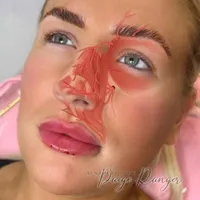 دوره آموزشی کامل بوتاکس/ژل/مزوتراپی/نخ/آنزیم|خدمات آموزشی|کرمانشاه, |دیوار