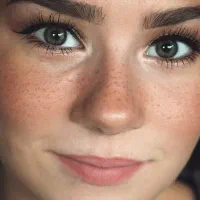 معجزه پسوریازیس کشف شد