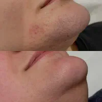 مرکز تخصصی لیزر بانوان
