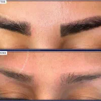 میکرو و ریموو|خدمات آرایشگری و زیبایی|قم, شاه سید علی|دیوار