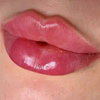 ژل لب گونه چانه،فول فیس لیفت نخ/لیزرآنزیم بوتاکس|خدمات آرایشگری و زیبایی|مشهد, هفت تیر (آب و برق)|دیوار