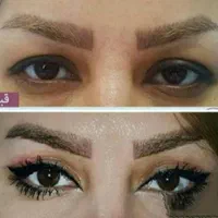 بوتاکس وتزریق ژل لیفت نخ بلفاروساکشن وکاشت مو|خدمات آرایشگری و زیبایی|مشهد, آزادشهر|دیوار