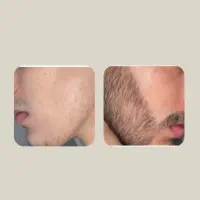 20روزه|آرایشی، بهداشتی، درمانی|بیرجند, |دیوار