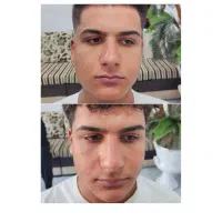 نیازمند مدل آقا جهت پاکسازی و فیشیال حرفه ای