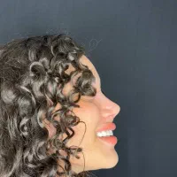 50%تخفیف ویژه عمل جراحی بینی بدون تامپون لیفت|خدمات آرایشگری و زیبایی|فردیس, طالقانی|دیوار