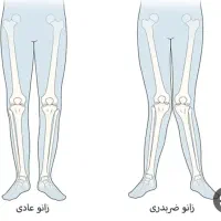 مرکز ارتوپدی درمان غیرجراحی انحرافات زانو