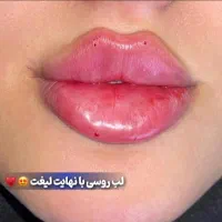 تزریق ژل و بوتاکس
