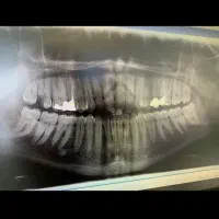 خدمات دندانپزشکی کودکان و بزرگسالان با تخفیف ویژه