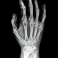 رادیولوژی در منزل آلارا|خدمات آرایشگری و زیبایی|مشهد, احمدآباد|دیوار