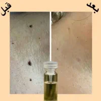 درمان|آرایشی، بهداشتی، درمانی|فیروزآباد (لرستان), |دیوار