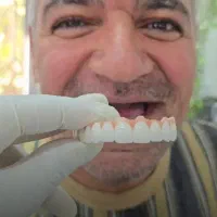 دندانپزشکی زیبا ایمپلنت ۸،۵۰۰ صادقیه غرب تهران|خدمات آرایشگری و زیبایی|تهران, فردوس|دیوار