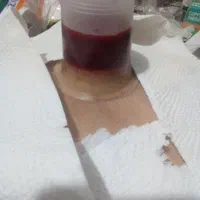 آموزش و انجام تزریقات حجامت زالودرمانی|خدمات آرایشگری و زیبایی|دورود, |دیوار