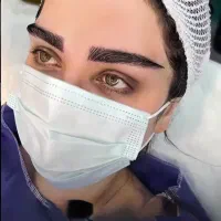 کاشت ابرو تضمینی ۱۲۹۰۰ بلفاروپلاستی توسط پزشک ۸۹۰۰