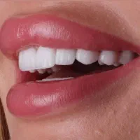 دندانپزشکی و ایمپلنت و کامپوزیت و ارتودنسی|خدمات آرایشگری و زیبایی|سرپل ذهاب, |دیوار