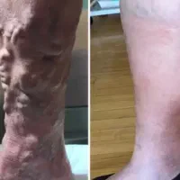 کلینیک واریس