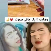 معجزه ی چاقی صورت