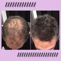 میتونی با راهکار ها ، تو خونه درمانش کنی