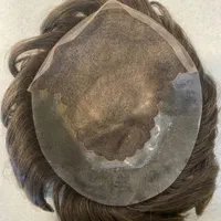 پروتز مو|آرایشی، بهداشتی، درمانی|تهران, نارمک|دیوار