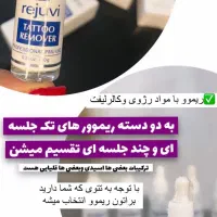 ریموو تتو در یک جلسه با متریال برند|خدمات آرایشگری و زیبایی|بهار, |دیوار