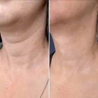کلینیک تخصصی پوست و زیبایی|خدمات آرایشگری و زیبایی|شیراز, ارم|دیوار
