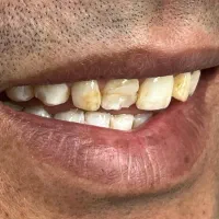 درمان دندان با شرایط دلخواه + ویزیت رایگان|خدمات آرایشگری و زیبایی|مشهد, منزل آباد|دیوار