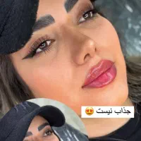 تخفیف ویژه فیلر هر سی سی ۶۰۰هزارتومان اصلی تضمینی