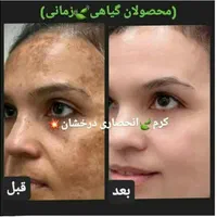 (کرم ضدلک و روشن کننده درخشان)بدون بازگشت|آرایشی، بهداشتی، درمانی|شیراز, قصرالدشت|دیوار