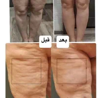 لاغری، تناسب اندام و لیزر در یک مرکز تخصصی|خدمات آرایشگری و زیبایی|کرج, مهرویلا جنوبی|دیوار