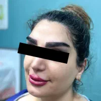 کاشت ابرو زیر بیست میلیون|خدمات آرایشگری و زیبایی|گرگان, |دیوار