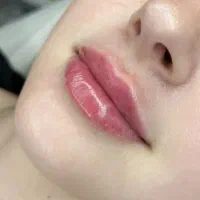 مرکز زیبایی با بروزترین دستگاه های روز دنیا|خدمات آرایشگری و زیبایی|ماهدشت, |دیوار