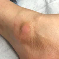 پدیکور پا ،رفع تیرگی ،قوزک پا|خدمات آرایشگری و زیبایی|پاکدشت, پاکدشت (مامازند)|دیوار