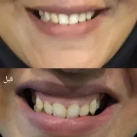 همکاری با لیدر عرب ۵۰ درصد بازاریاب( مشتری یاب)|استخدام درمانی، زیبایی، بهداشتی|مشهد, مصلی (کارمندان اول)|دیوار